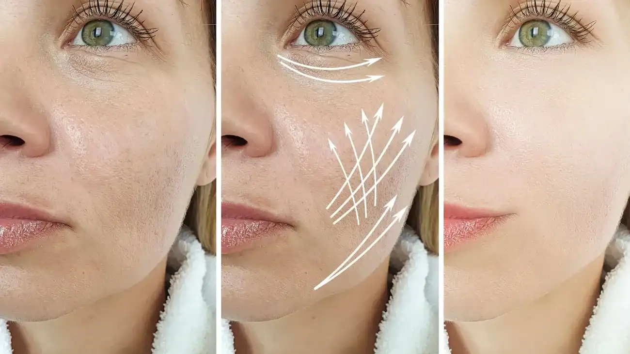 Can One Treatment Really Tackle More Than One Skin Concern Oxshott?