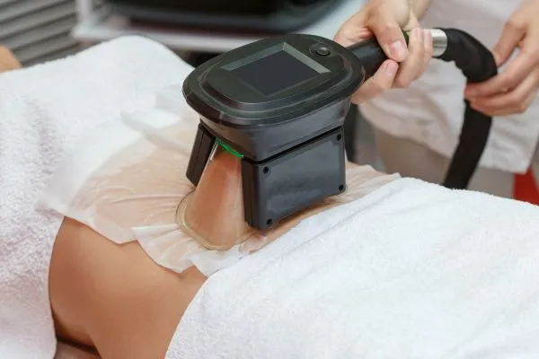 Image of person having fat freezing treatment to help weight gain Oxshott