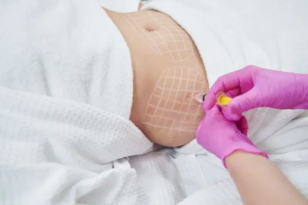 image of fat dissolving injections on love handles to help combat weight gain Oxshott