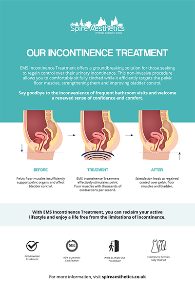 image of how urge incontinence Oxshott treatment works