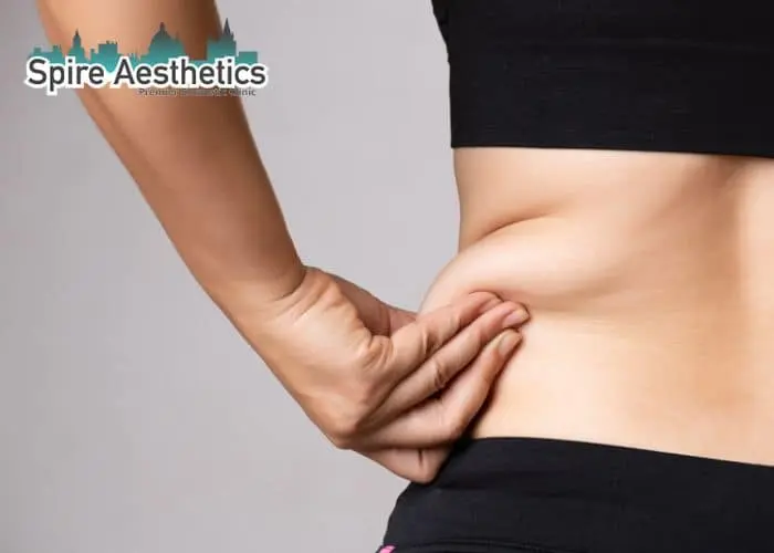 Image of woman pinching fat on their hips Oxshott. Fat Freezing treatment