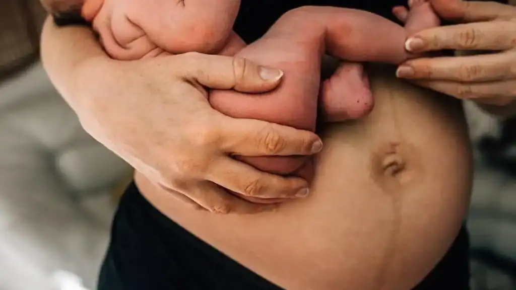 Why Is My Stomach Still Big After Pregnancy Oxshott?