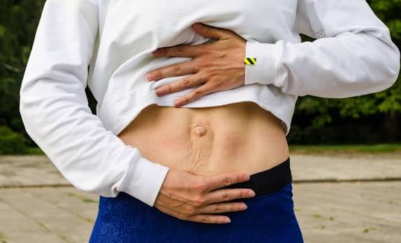 When Could Diastasis Recti Be the Missing Piece of the Puzzle Oxshott?